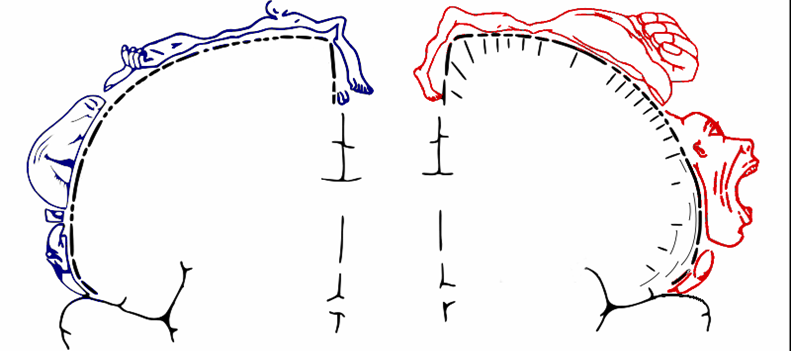 Podologue, podologie, posture, posturologie, sport, podologue du sport, équilibre, biomécanique, bilan postural, bilan podologique, semelles orthopédiques, semelles posturales, orthèses plantaires, mal de dos, lombalgie, cervicalgie, maux de tête, arthrose, arthrite, tendinite, TFL, patte d’oie, épine calcanéenne, myo-aponévrosite, hallux valgus, hallux rigidus, griffes d’orteil, Morton, cors, durillons, scoliose, fibromyalgie, instabilité, vertiges, ostéopathie, Essonne, Vigneux, Paris.